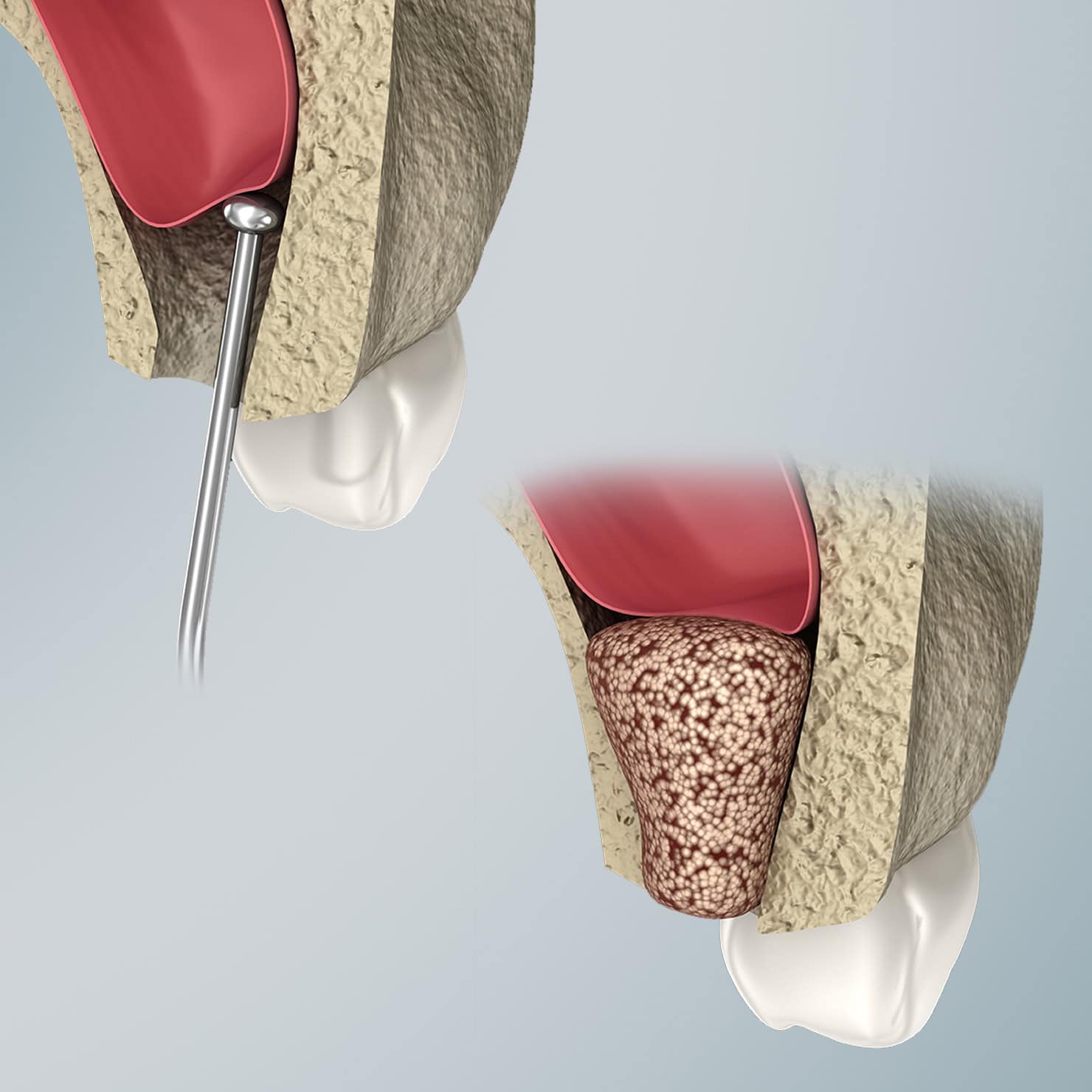 procedure